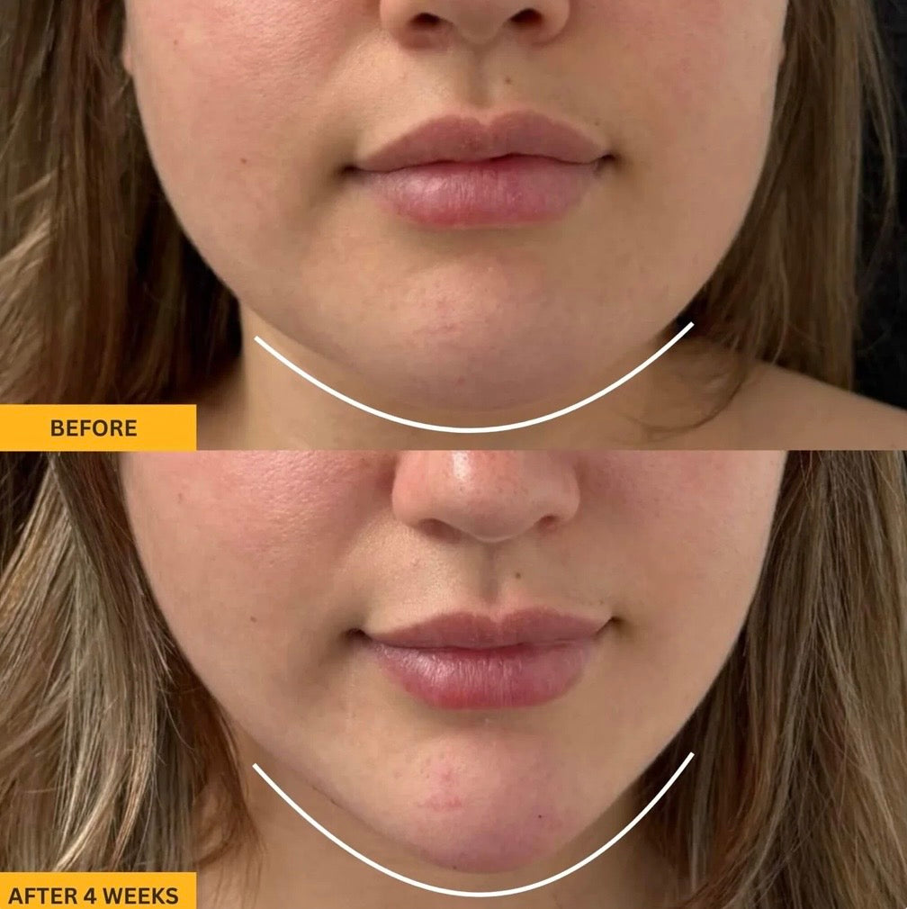 4-In-1 Lymphatic Face Brush