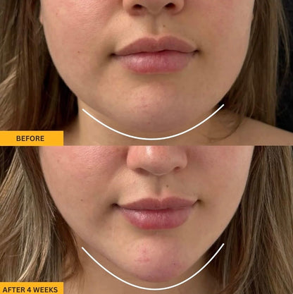 4-In-1 Lymphatic Face Brush
