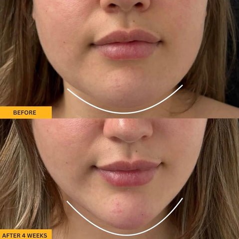 4-In-1 Lymphatic Face Brush